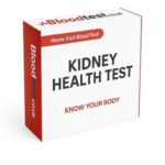 Kidney Blood Test Guide for Newark-On-Trent Residents