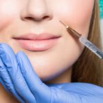 Lip Filler Simulation: Visualise Your Perfect Look!