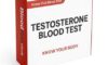 Testosterone Blood Test: Essential Information for King’s Lynn